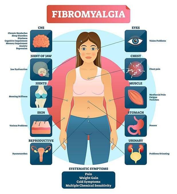 8 Types Of Fibromyalgia Pain Explanations , Best Acupuncture in Utah County Lotus Spring Acupuncture3