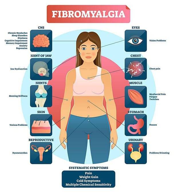 8 Alarmed Types Of Fibromyalgia Pain Which One Do You Suffer