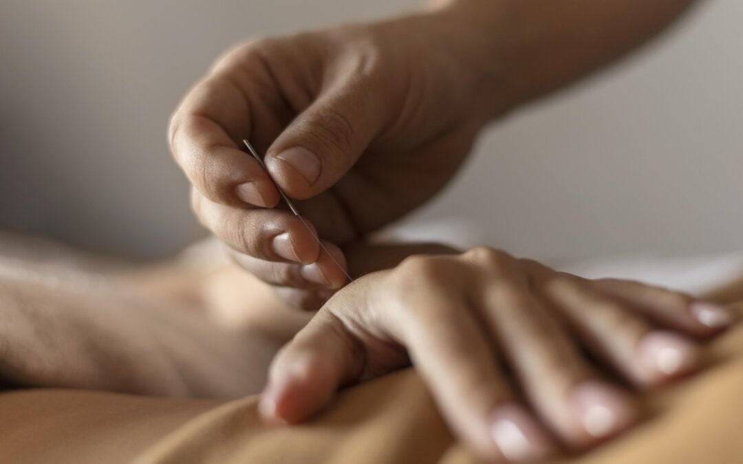 What Can Acupuncture Treat? Best acupuncture in utah county