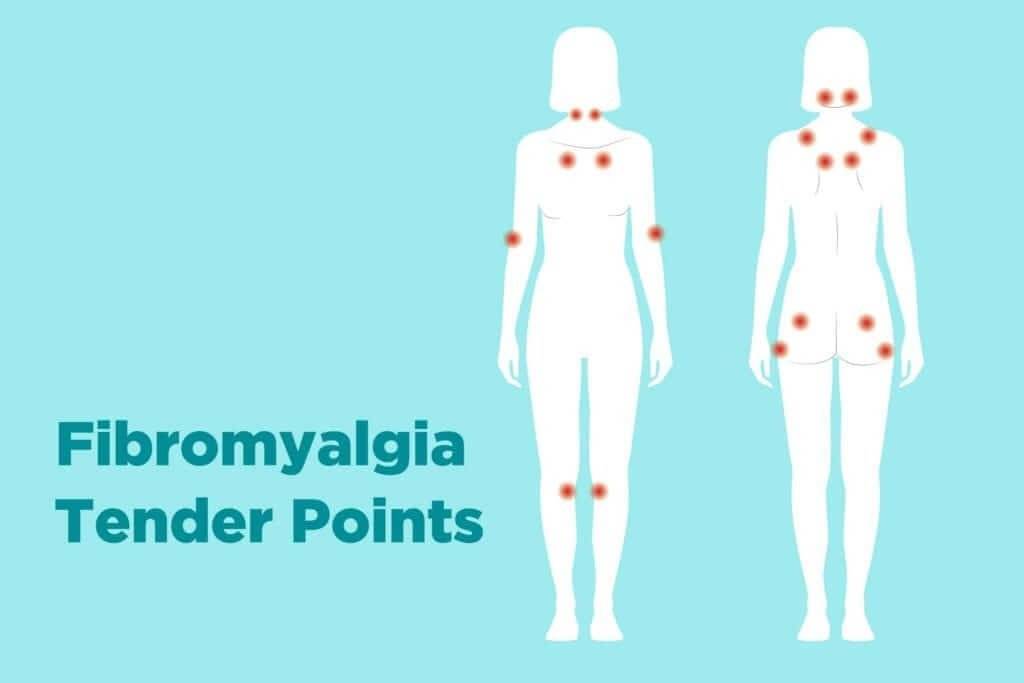 acupuncture for fibromyalgia pain - Best acupuncture in Utah county 4