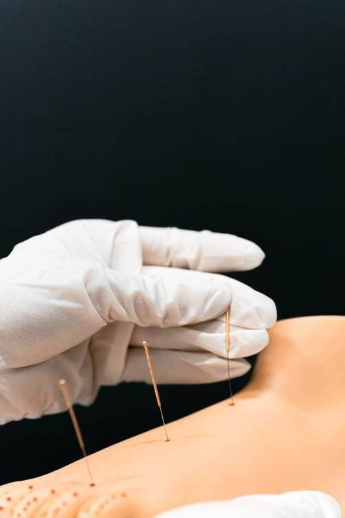 Acupuncture Insurance Coverage In Utah - Best Acupuncture In Utah 5