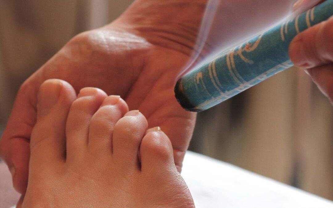 Acupuncture & Moxibustion for Breech Babies | #1 Best Natural Treatment