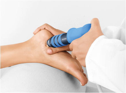 shockwave therapy for plantar fasciitis